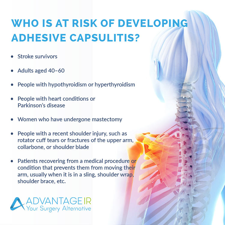 Who is at risk for Adhesive Capsulitis